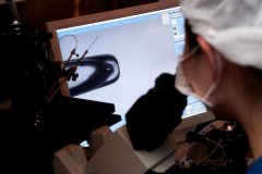 多囊姐妹的试管